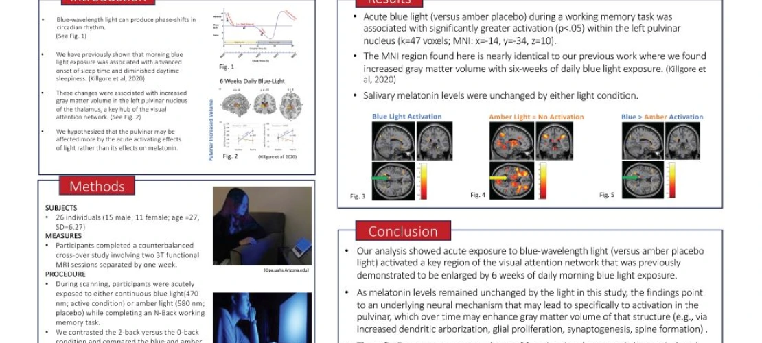 Acute Blue Light Exposure Increases Activation in the Pulvinar Nucleus 2022 Sleep Conference Poster